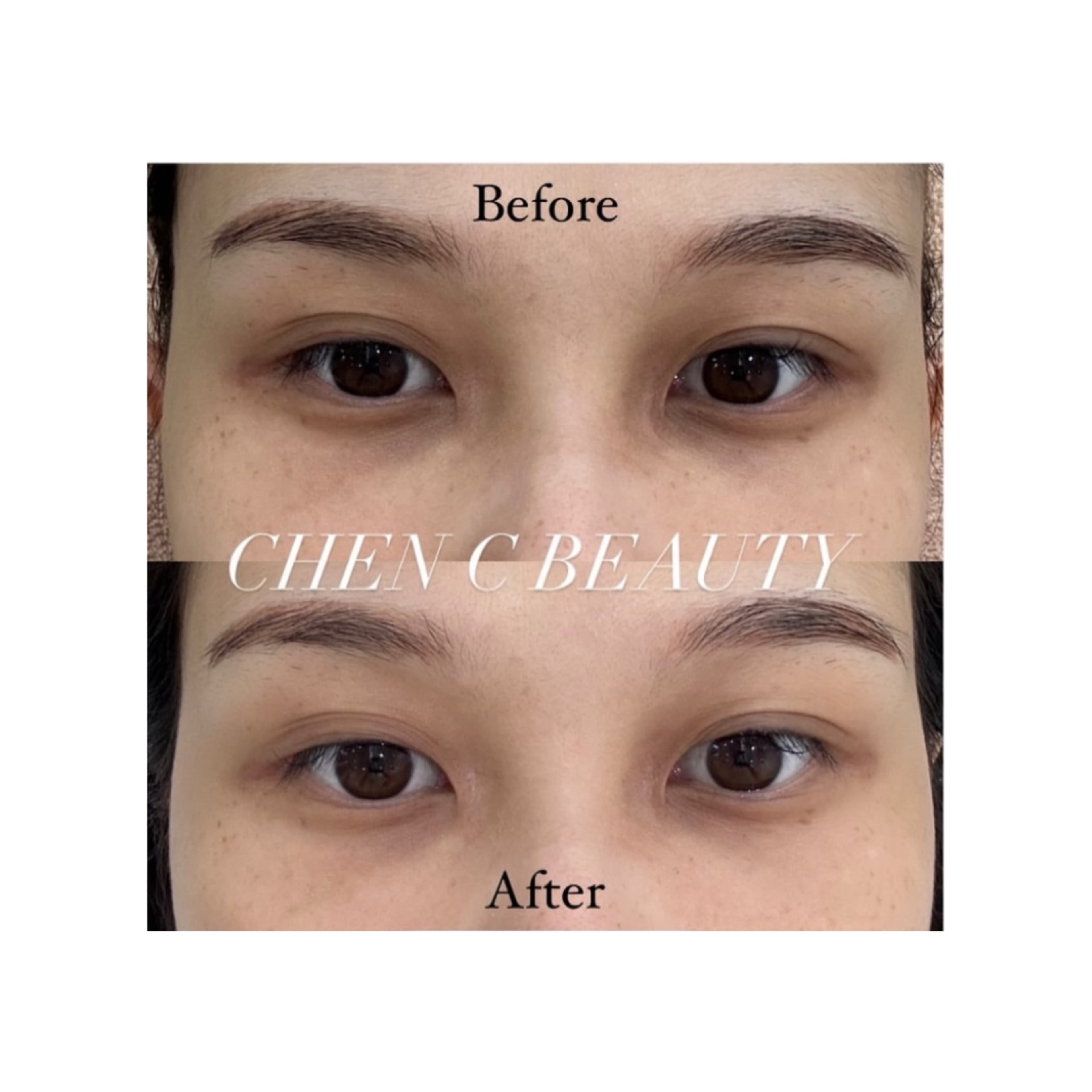 辰皙美學肌膚管理