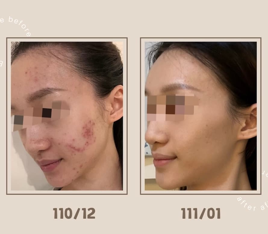 辰皙美學肌膚管理