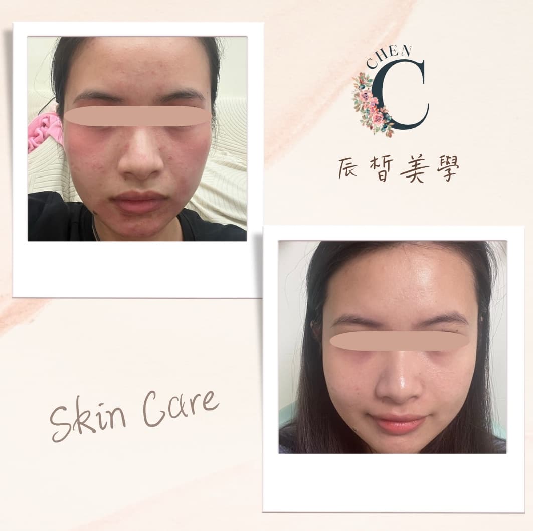 辰皙美學肌膚管理