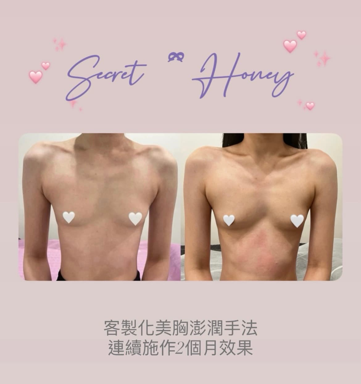 覓蜜🍯小臉拉提術|體雕課|美胸按摩|台北