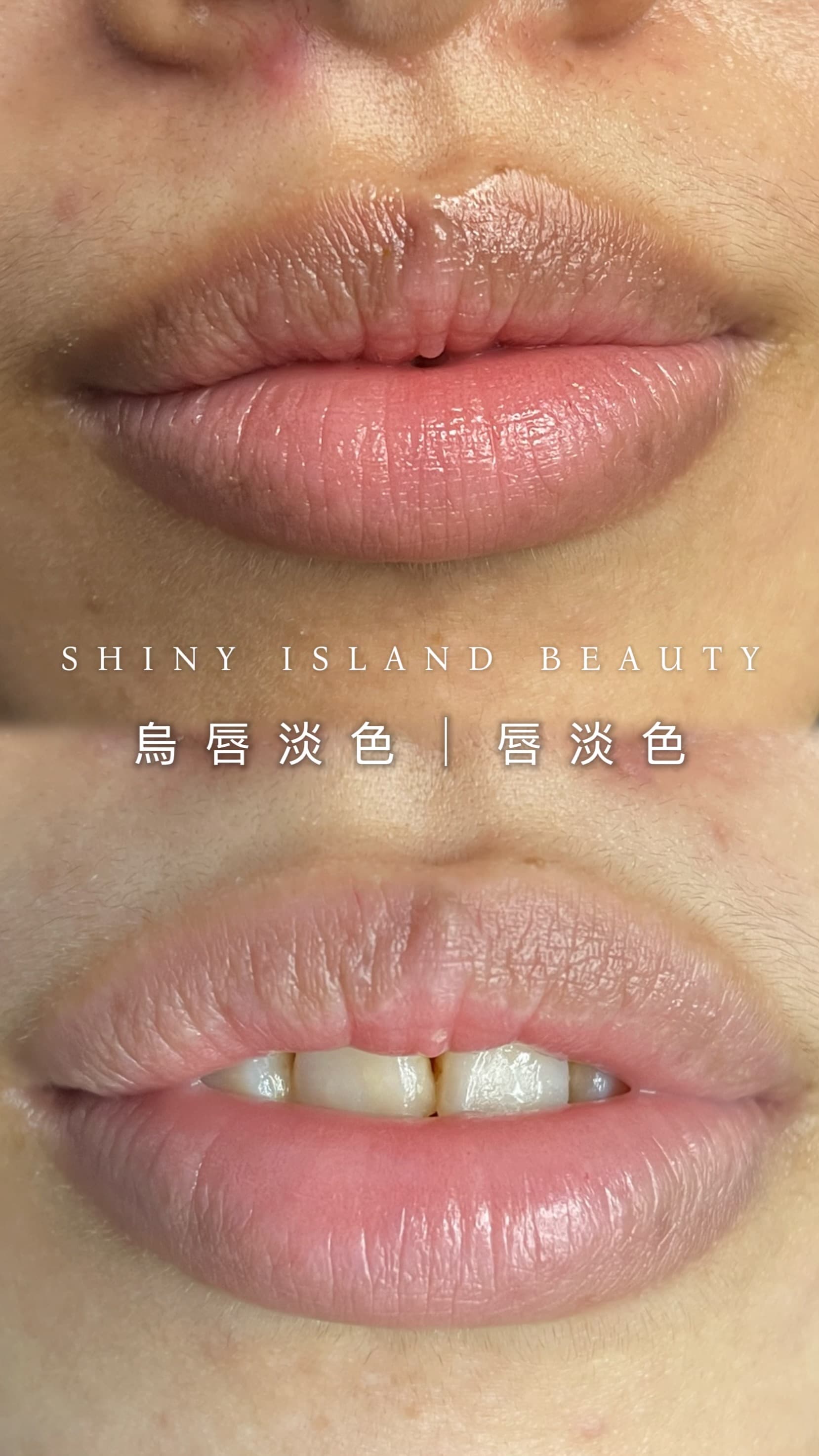 Shiny Island Beauty